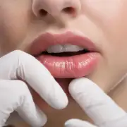 如何预防闭合性粉刺在嘴唇和鼻子周围出现？