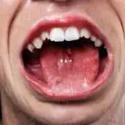 为什么有时候我们会感觉嘴里有异物感或口腔溃疡的症状?